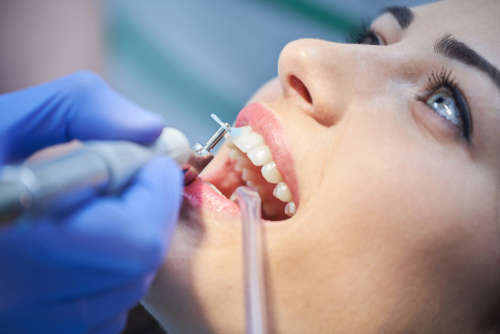 teeth cleaning - is the foundation to good oral health care