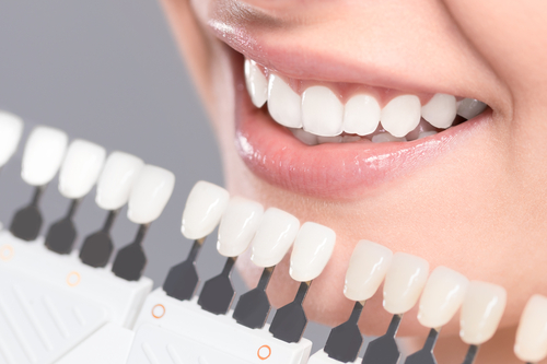 ZOOM! teeth whitening - a treatment at Beachside Smiles that will give you a beautiful smile