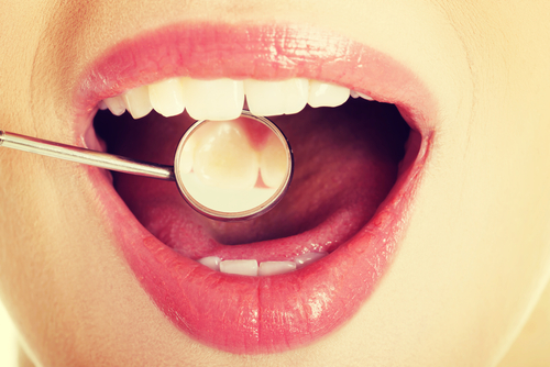 dental crown manhattan beach dentist