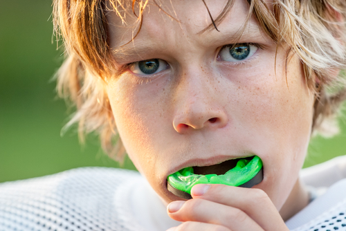 Sports Mouthguards - helping to protect your teeth, gums and mouth