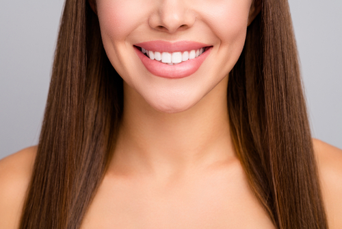 Veneers 101 - Beachside smiles