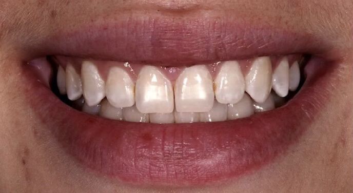 Dentists in Riverside CA Riverside Family Dental Practice