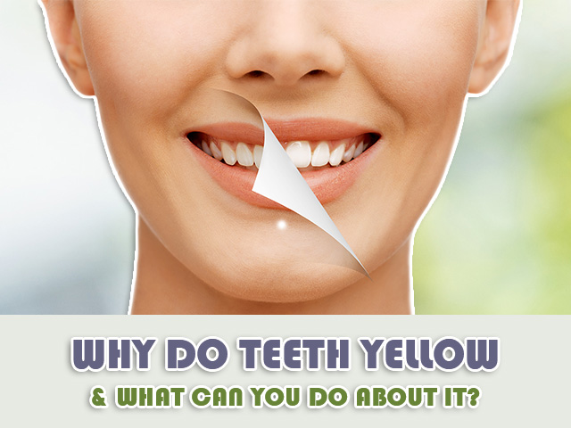 Why Do Teeth Yellow & What Can You Do About It?