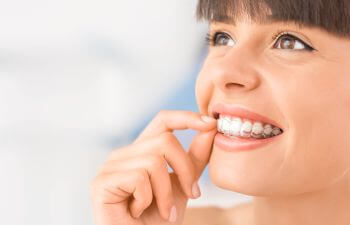 Woman putting Invisalign aligner on her upper teeth.